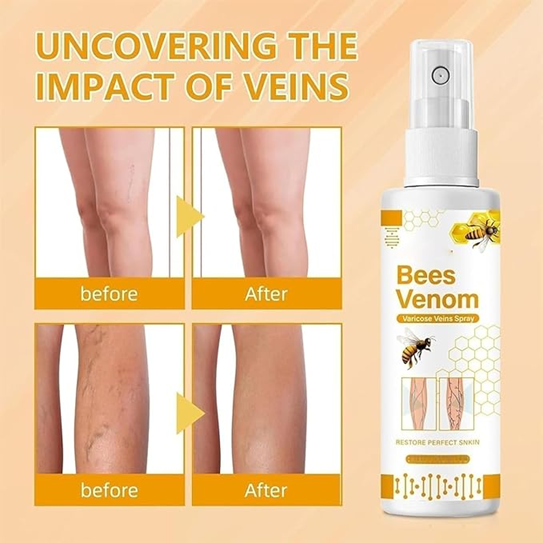 Bee Venom Varicose Veins Spray (Pack of 2)